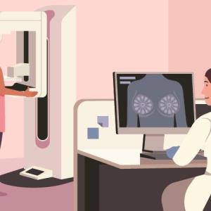 Mammo-50: Reduced mammogram frequency postsurgery may suffice for older women