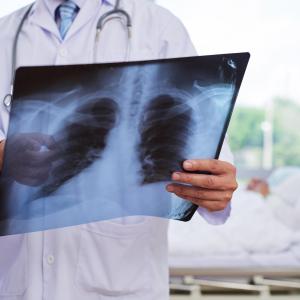 Add-on clarithromycin boosts recovery from pneumonia