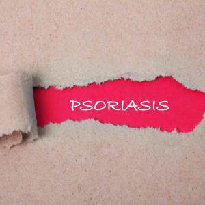 Risankizumab proven safe, effective in bio-naïve psoriasis patients