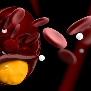 Add-on recaticimab cuts bad cholesterol in non-FH, mixed hyperlipidaemia patients
