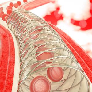 Favourable long-term results with zotarolimus-eluting stents in CTO