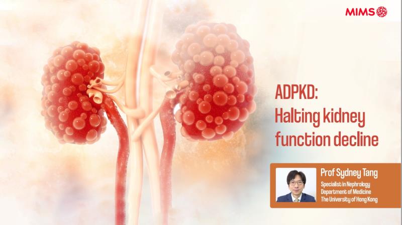 ADPKD: Halting kidney function decline